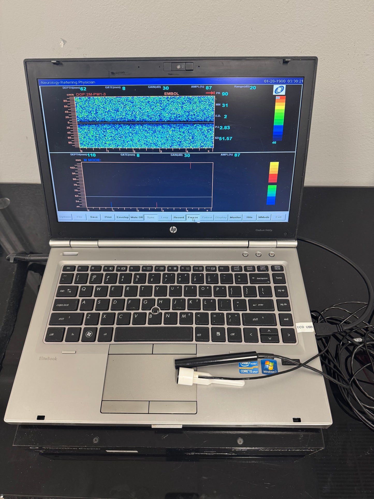Multigon Transcranial Doppler (TCD)