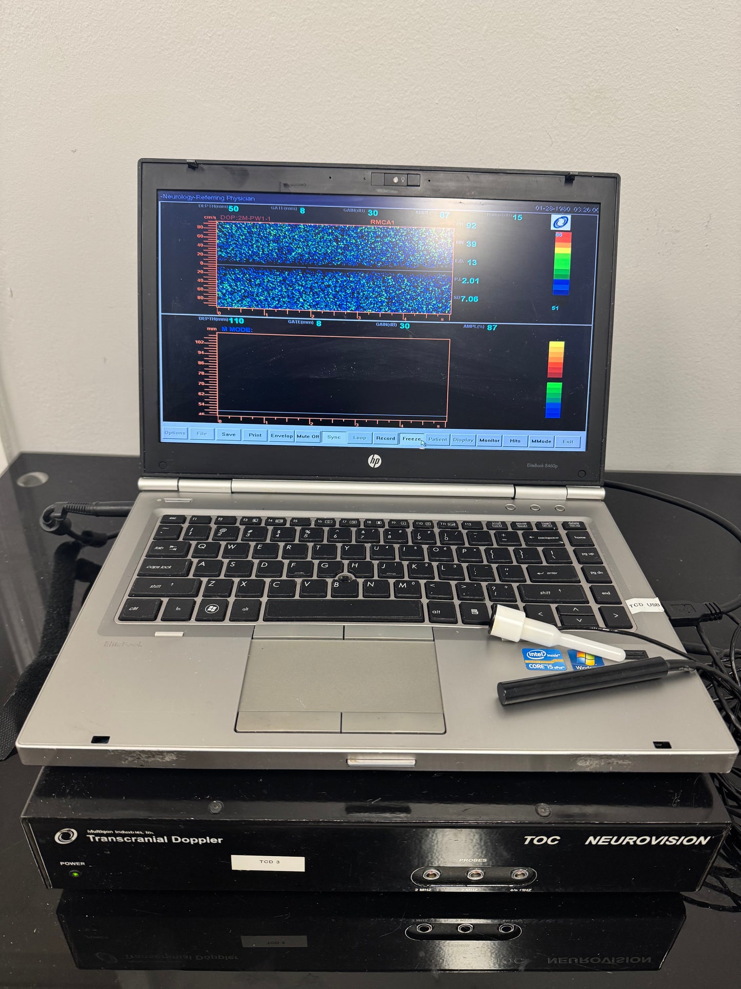 Multigon Transcranial Doppler (TCD)